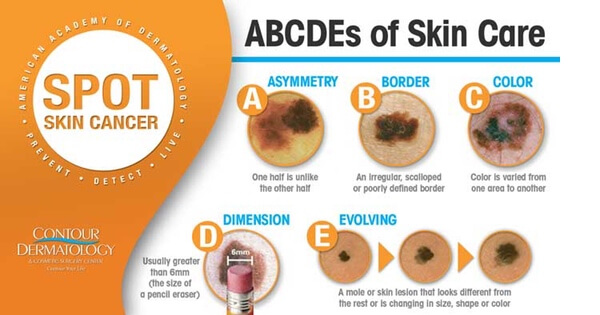 Skin-Cancer